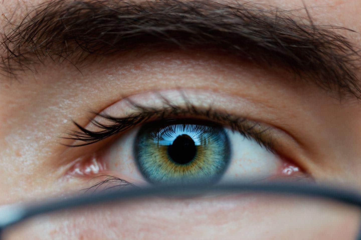 Yeux vairons problème de vue : Cette particularité affecte-t-elle la vision ?