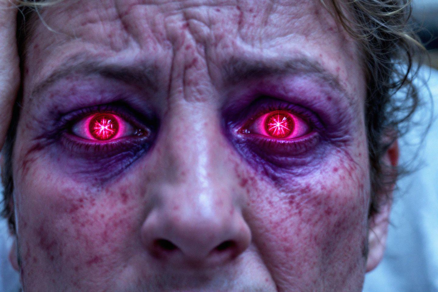 Yeux rouges et maux de tête : Quand ces symptômes doivent-ils inquiéter ?